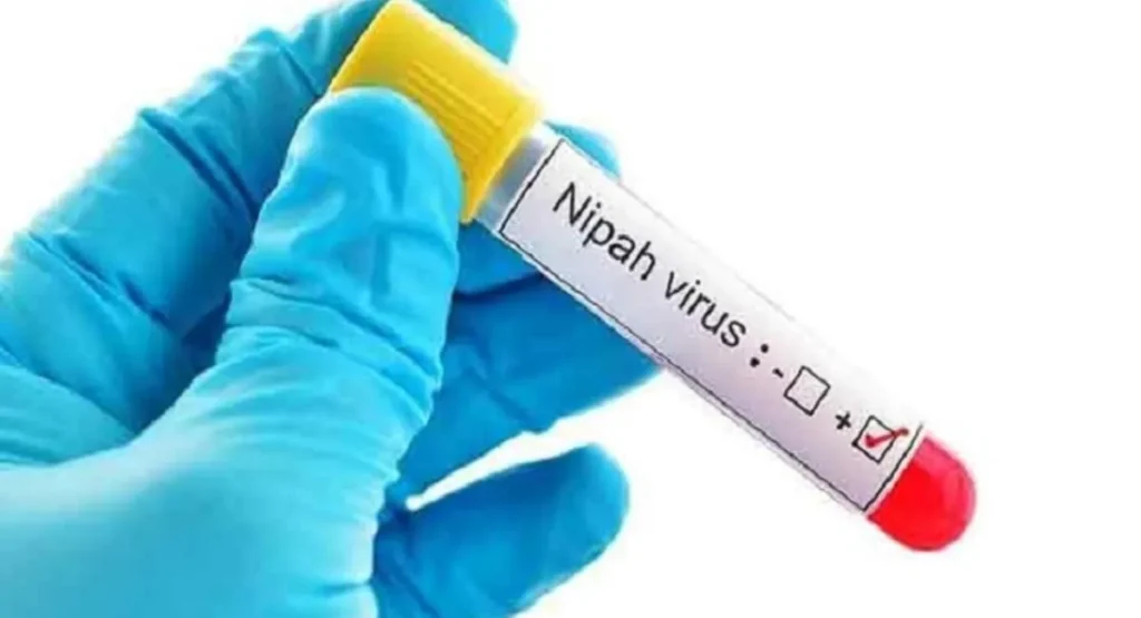 Nipah virus